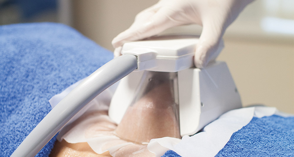 How Fat Freezing and HIFU Work Together? 2 Multiple Areas in One Session HIFU and Fat Freezing Wiltshire