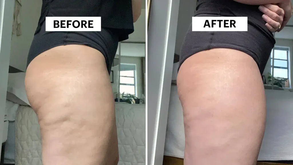 Do Toning Exercise Wiltshire Really Tackle Cellulite?
