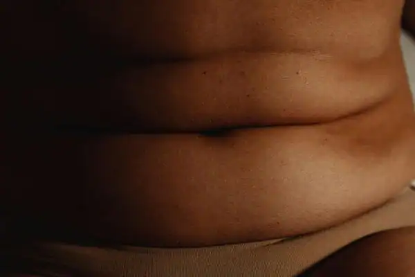 The Hidden Connection: How Stress Shapes Your Fitness and Body Composition 3 image of what stress can do on the stomach area and how Lipo 360 Wiltshire can help to change your body shape.
